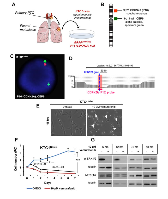 Figure 1: Model of primary resistance to vemurafenib using PTC patient-derived cells harboring the heterozygous BRAFV600E mutation and with P16 (CDKN2A) deletion.