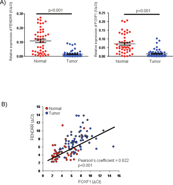 Figure 1:  FENDRR and  FOXF1 mRNAs are significant biomarkers of lung adenocarcinoma (LUAD).