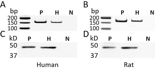Figure 1: The expression of GHRH receptor (GHRH-R) in the primary human hepatocytes and rat hepatocytes. 
