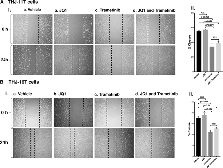 Figure 4: Trametinib and the combined treatment of JQ1 and trametinib inhibit ATC cell migration.