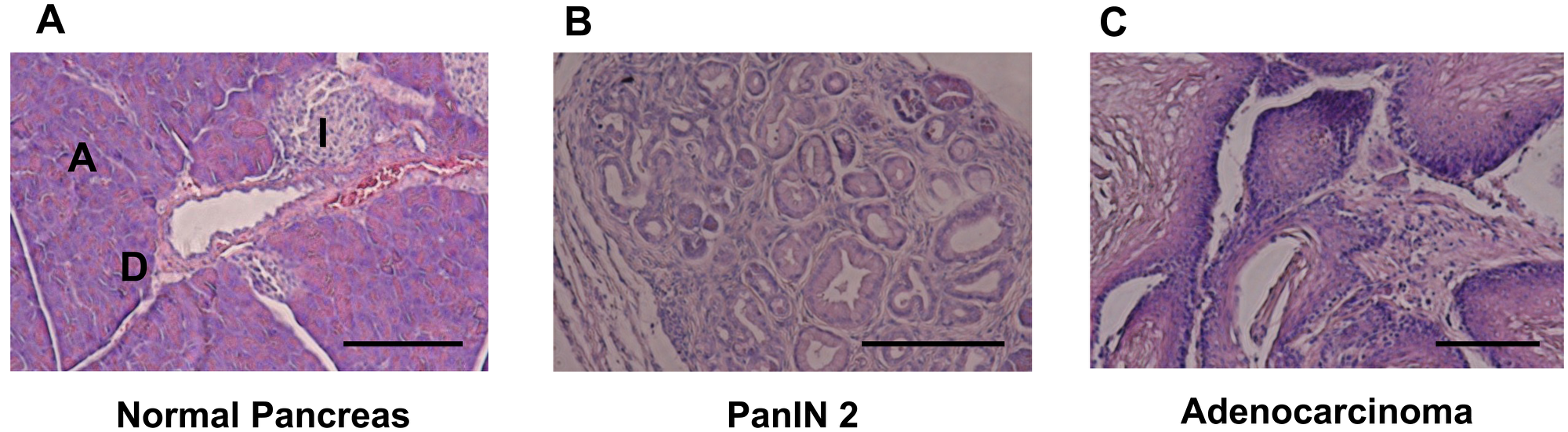 Figure 1: HE staining for pancreatic tissue.