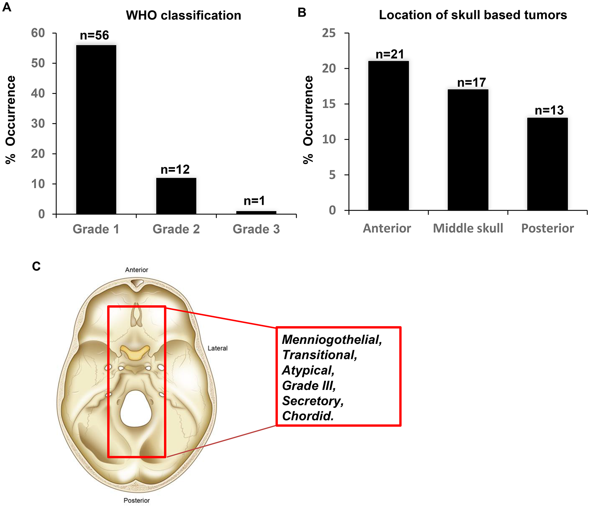Figure 1: Characteristics of the meningioma?s investigated in the study