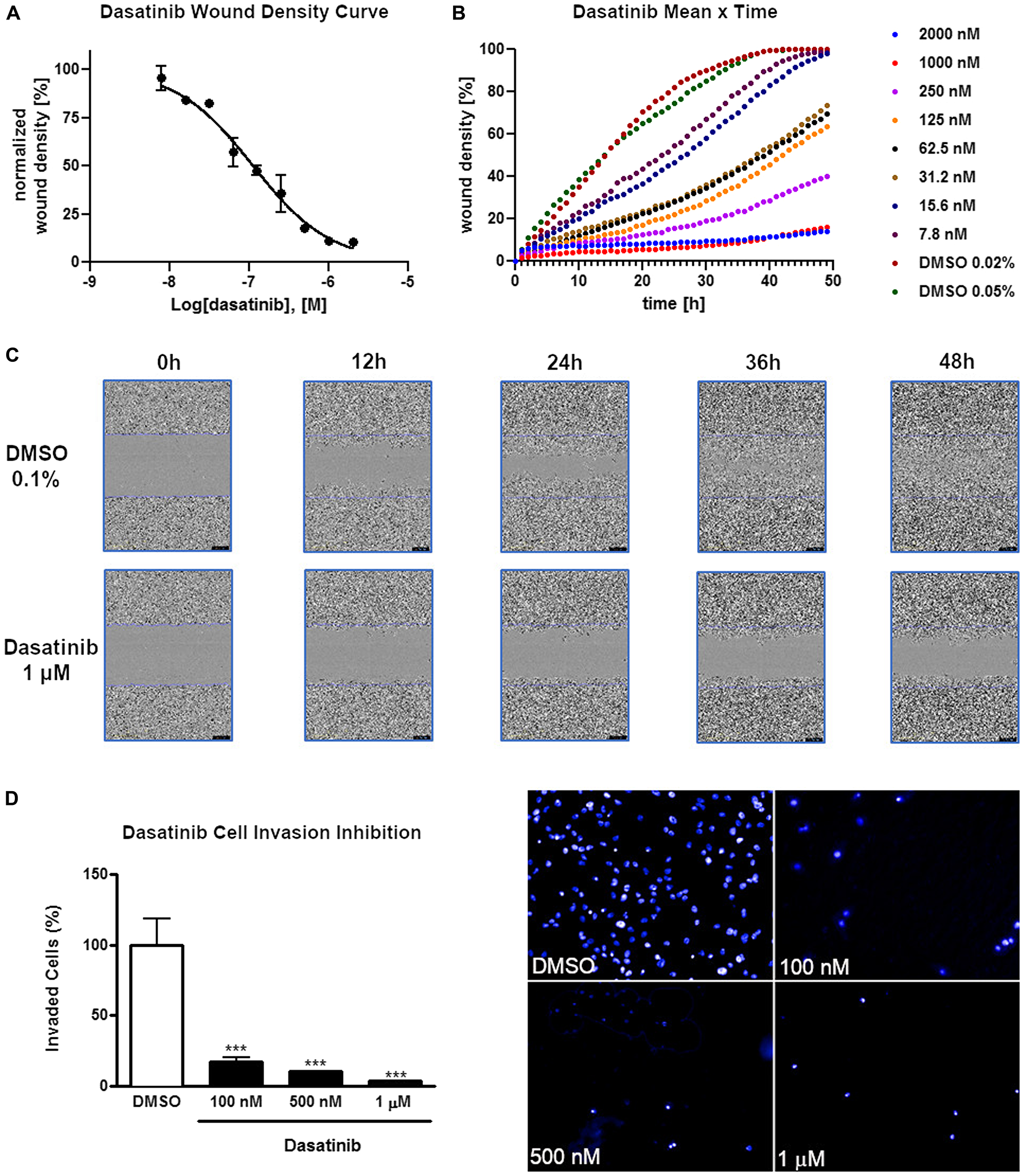 Figure 1: Inhibition of cell invasion and migration of AGP-01 cells by dasatinib.