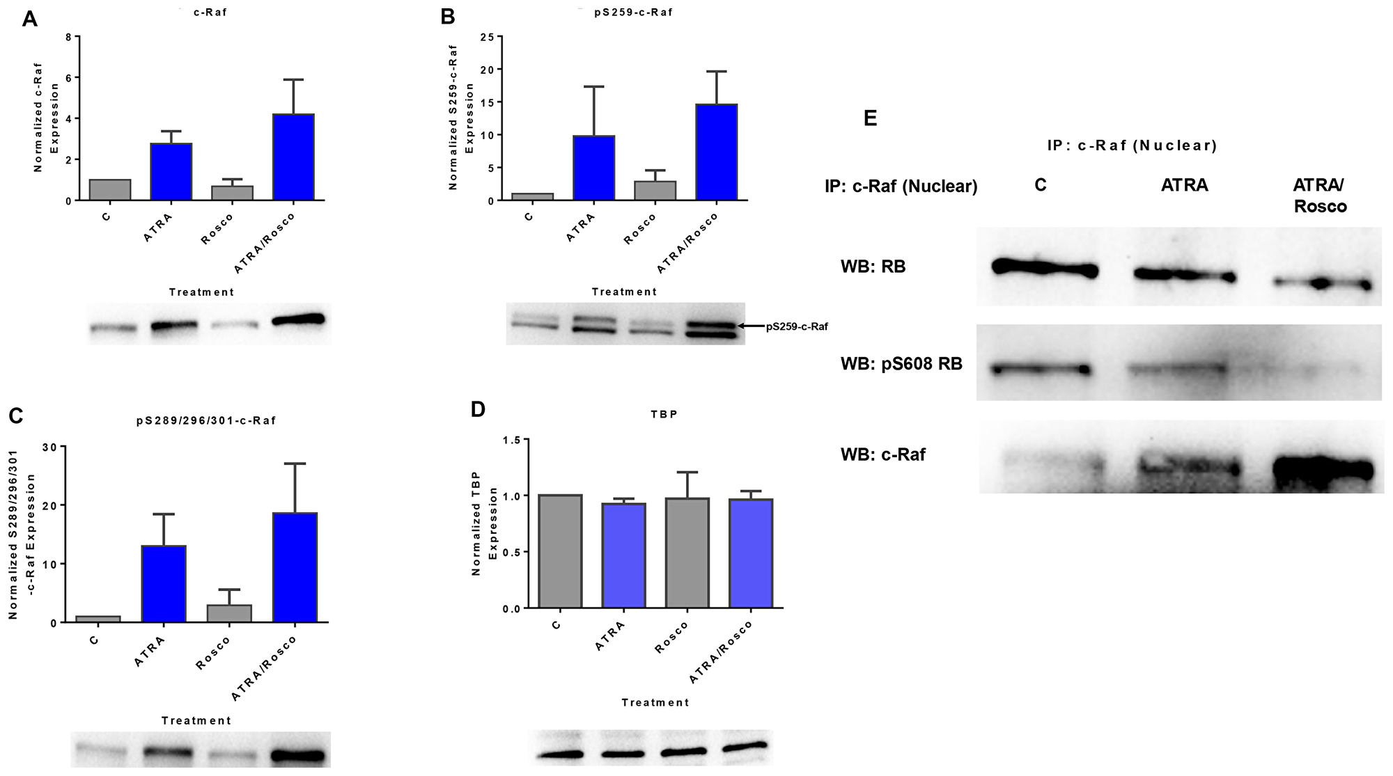 Figure 1: Roscovitine enhances the amount of ATRA-induced phosphorylated c-Raf and phosphorylated c-Raf in the nucleus modulates the RB protein functions.